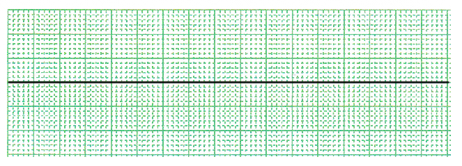 %e5%bf%83%e9%9b%bb%e5%9b%b3%e3%80%80%e5%bf%83%e9%9d%99%e6%ad%a2