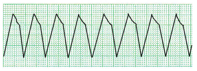 %e5%bf%83%e9%9b%bb%e5%9b%b3-vt